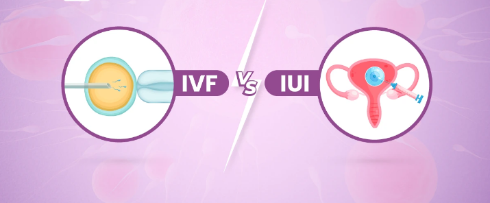 IVF - IUI