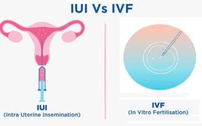 What Are the Differences Between IVF and IUI Pregnancy?